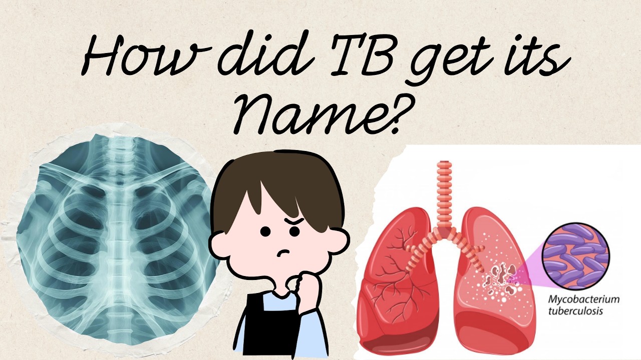 How Tuberculosis TB Got Its Name | History, Tubercles and the &ldquo;White Plague&rdquo;