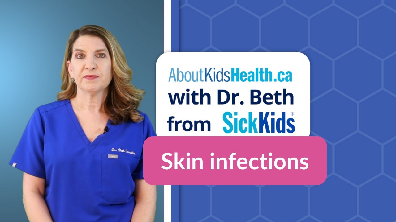 Skin infections: Five common skin infections and how to treat them | AboutKidsHealth at SickKids