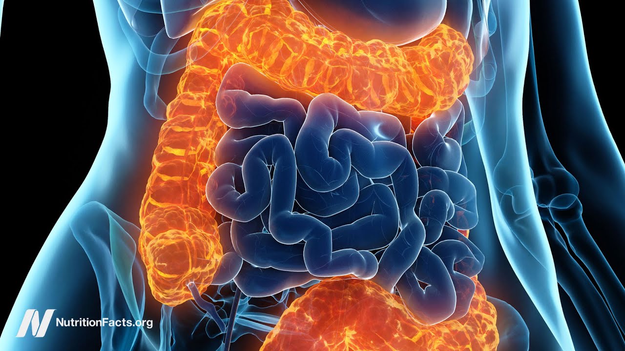 Fecal Transplants for Ulcerative Colitis, MS, Depression, Bipolar, and Alcoholism