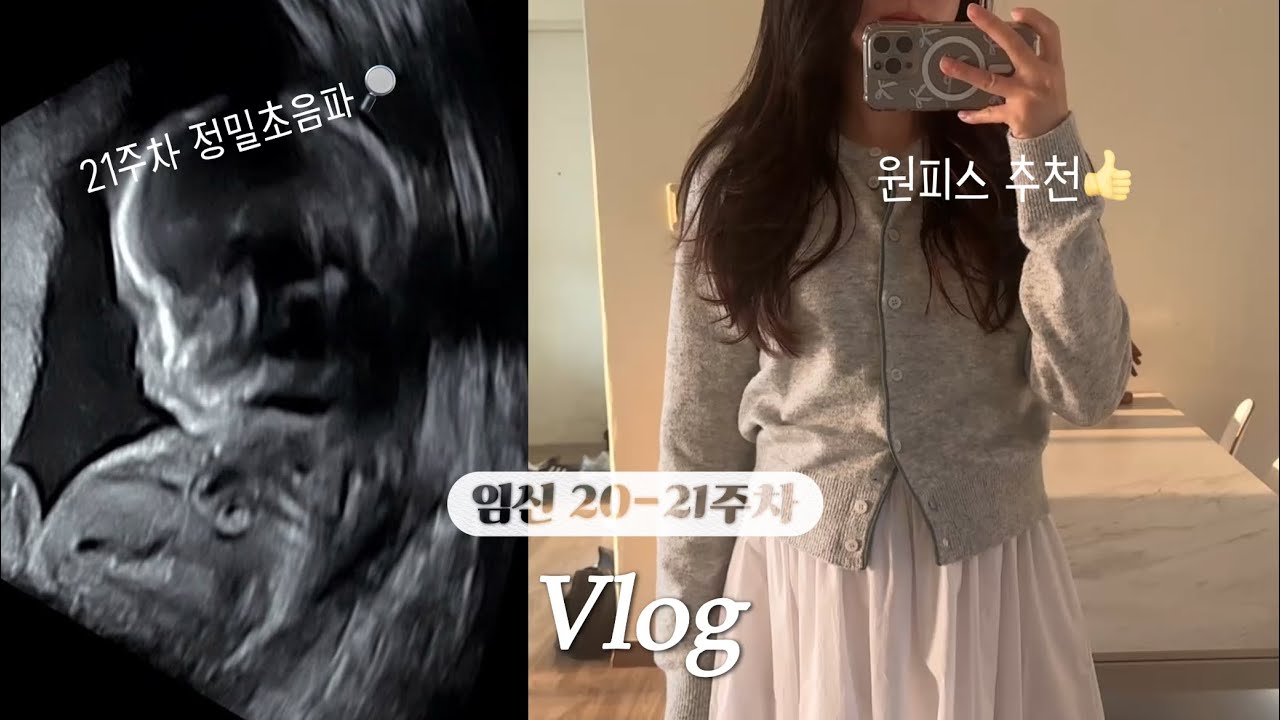 임신 20-21주차 | 봄여름 원피스 | 5주만에 보는 아가💛정밀초음파💛