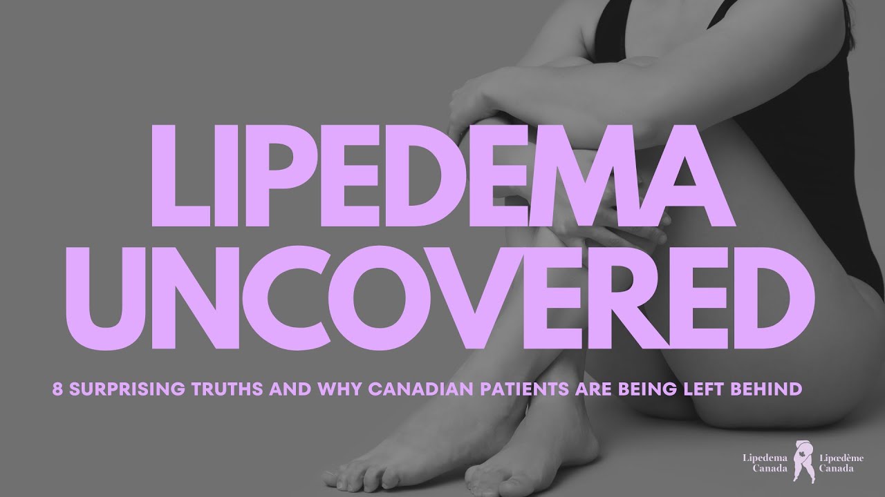 8 Surprising Truths About Lipedema – and How Canadians Are Still Being Left Behind