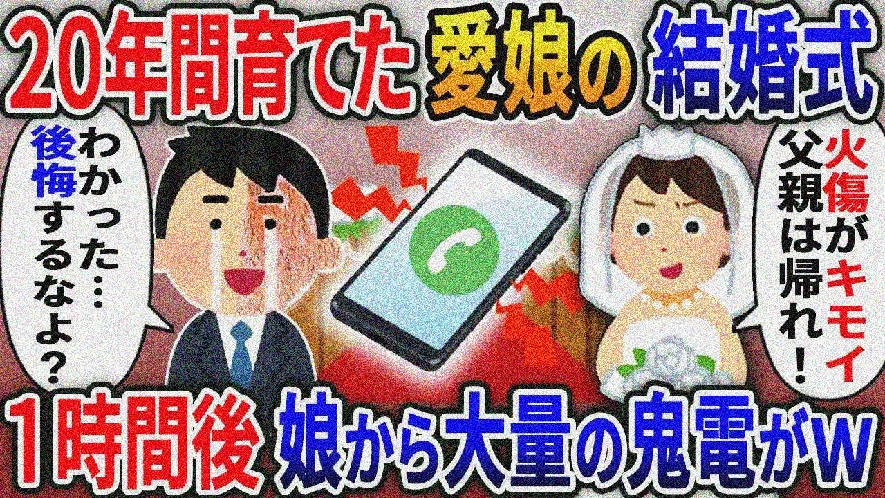 20年間大切に育てた娘の結婚式で「やけど跡があるバケモノ親父は来るな」→お望み通り帰ると娘と嫁が顔面蒼白にｗ【2ｃｈ修羅場スレ・ゆっくり解説】