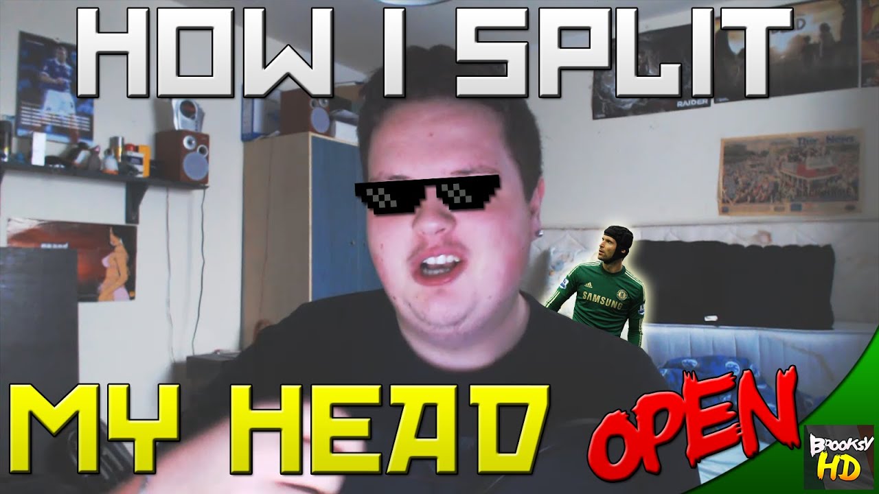 HOW I SPLIT MY HEAD OPEN!!! | Brooksy Vlogs
