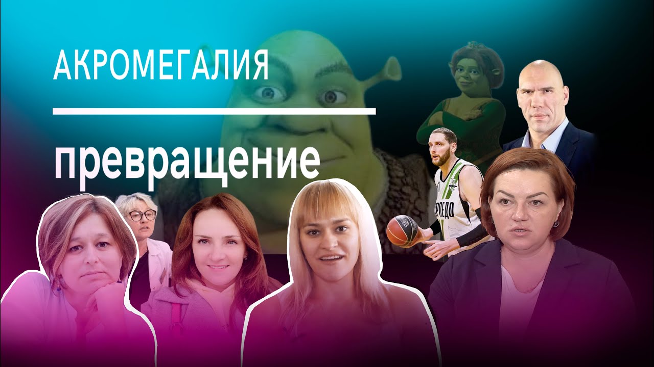 Я СТАЛА ПОХОЖА НА ФИОНУ, жить не хотелось. АКРОМЕГАЛИЯ: Внезапный рост конечностей