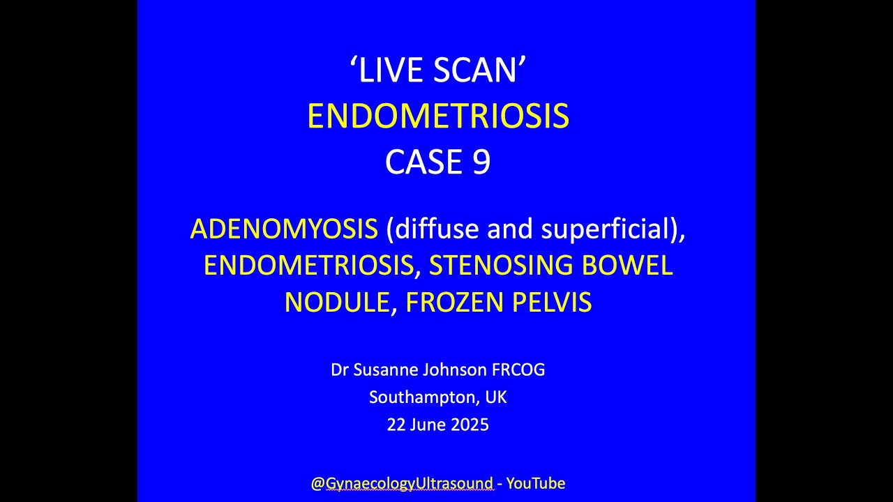 LIVE SCAN 9