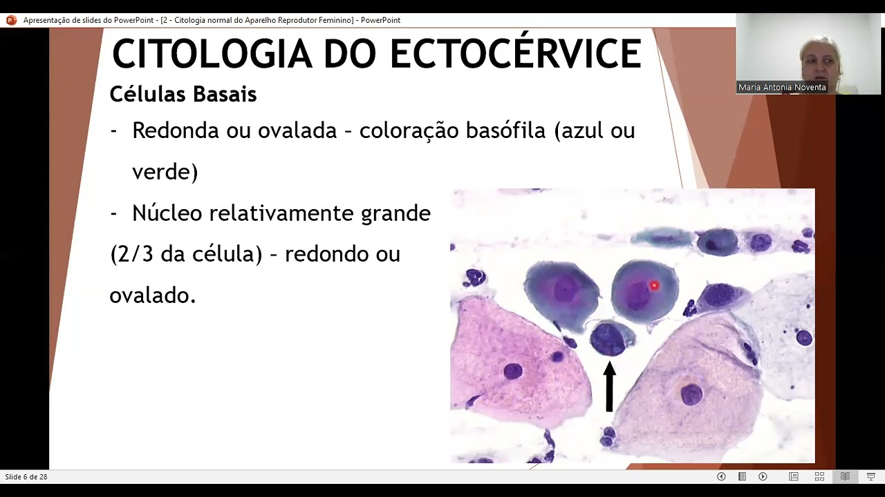 CITOLOGIA GINECOL&Oacute;GICA   CITOLOGIA NORMAL