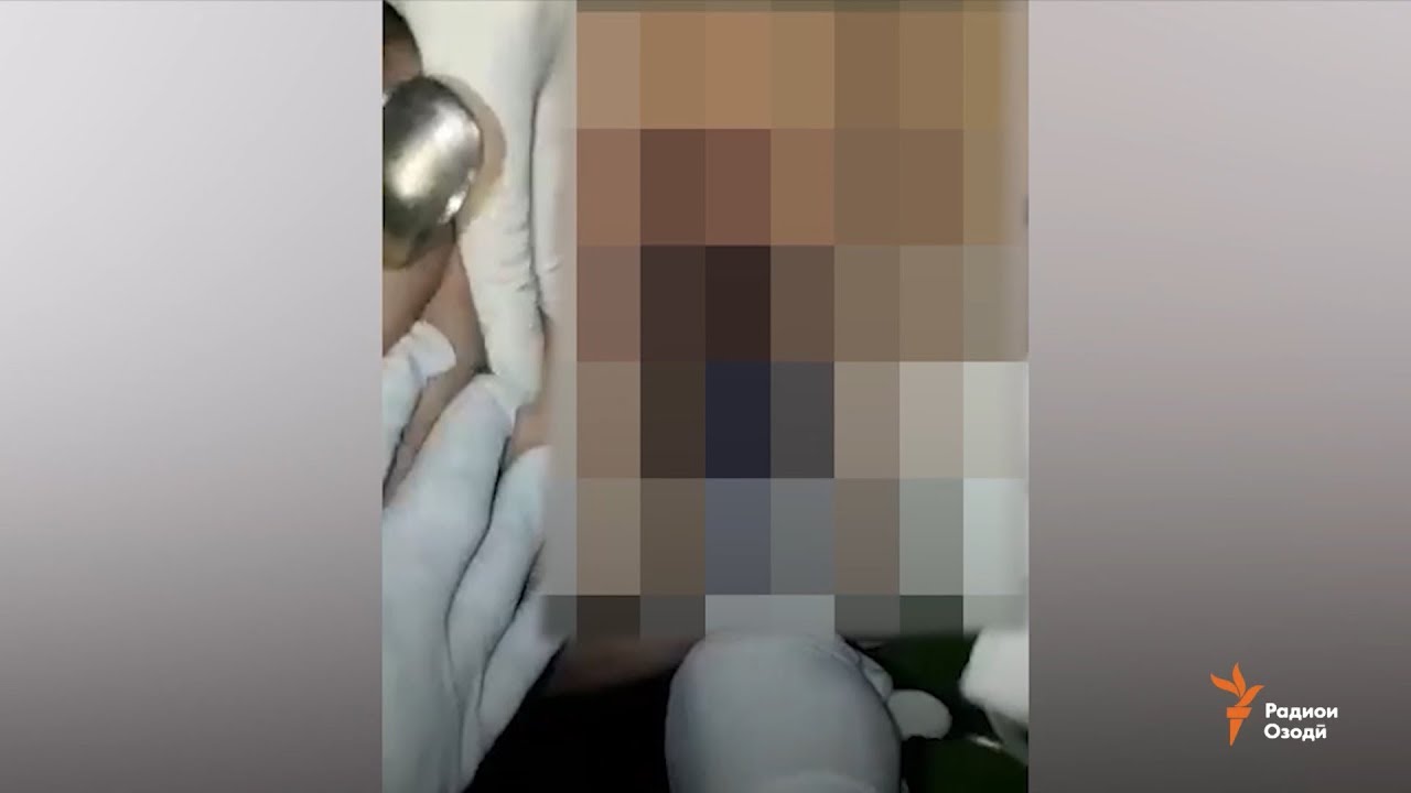 Шавҳар занашро бо сабзӣ ҷазо дод, табибони гинеколог таҳқири ӯро идома доданд