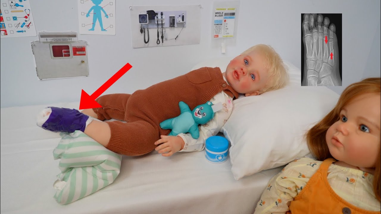 Reborn Brody broke his leg at the park and gets a cast at the hospital