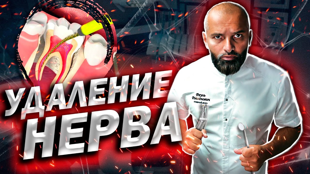 УДАЛЕНИЕ ЗУБНОГО НЕРВА! БОЛЬНО ИЛИ НЕТ?