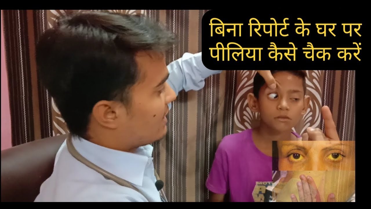 Jaundice How To Check Jaundice At Home Without Any Report |पीलिया (जौन्डिश) के लक्षण