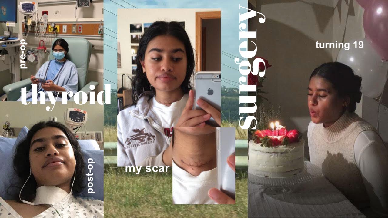 surgery vlog || recovering from a right thyroid lobectomy: storytime, vlog & turning 19 :)