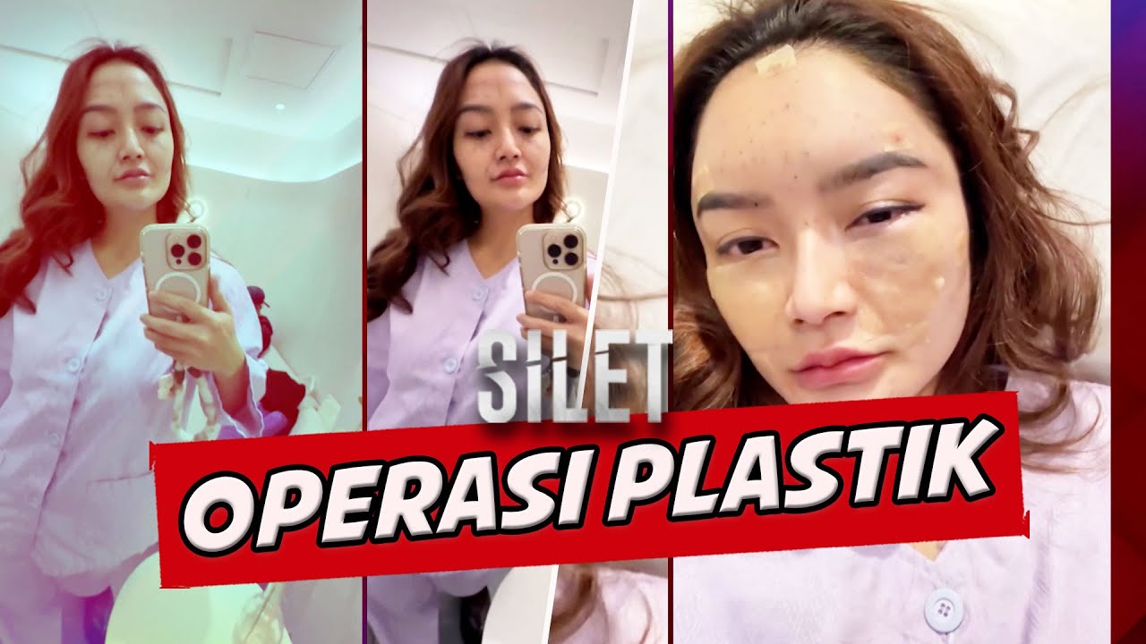 Jalan-Jalan Ke Korea Siti Badriah Pilih Operasi Dadakan | SILET