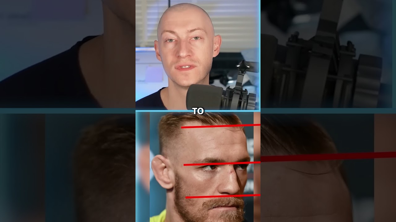 Conor McGregor's Hair Transplant