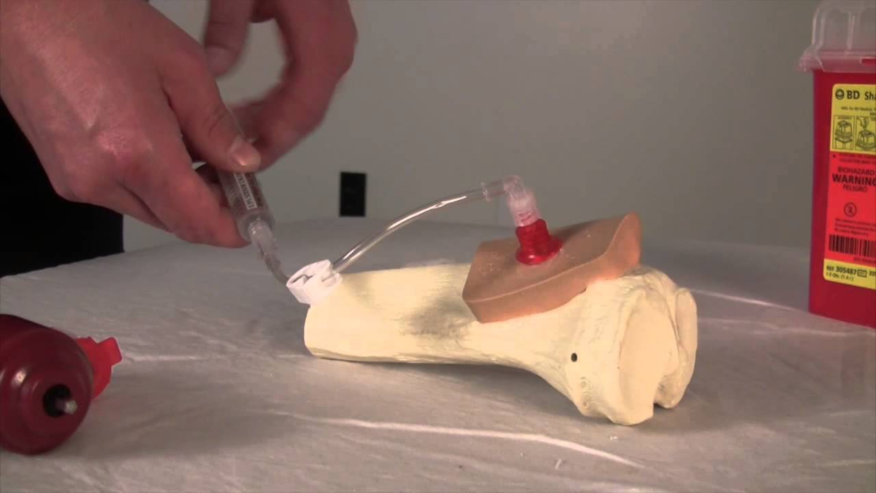 Intraosseous Medication Administration