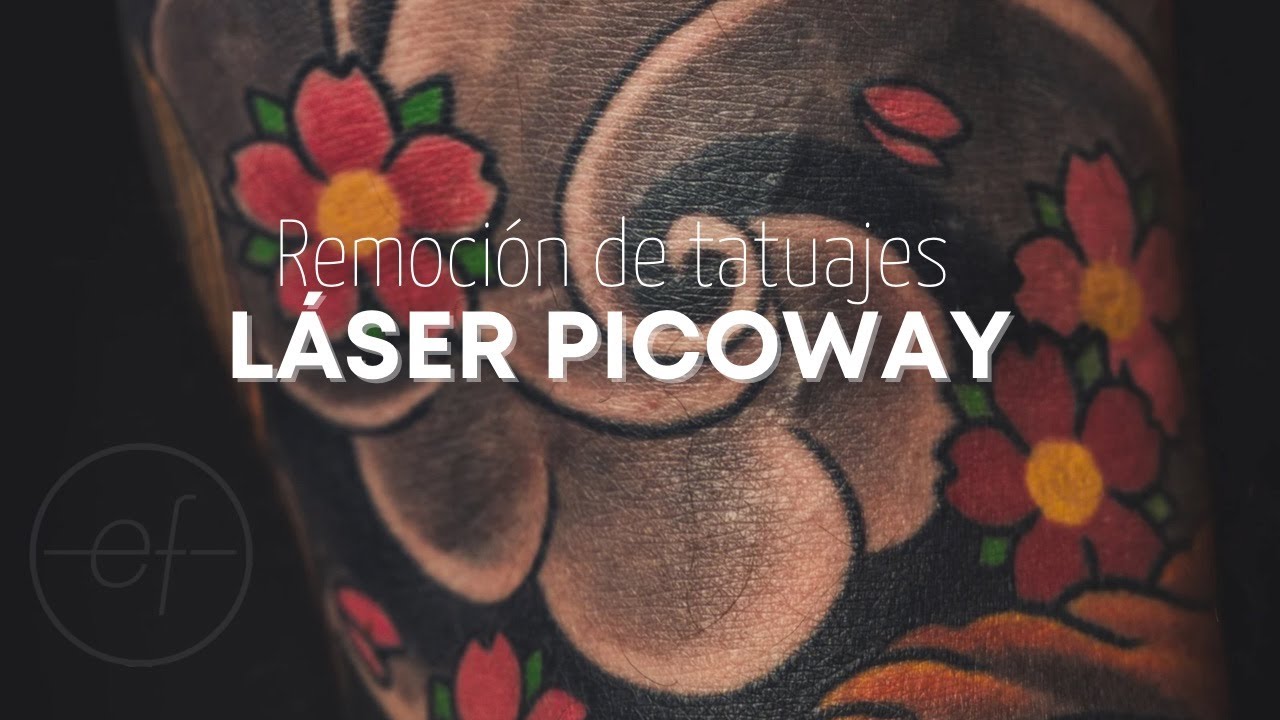 REMOCIÓN DE TATUAJES CON LÁSER PICOWAY Y PICOPLUS EN EF MEDICAL GROUP