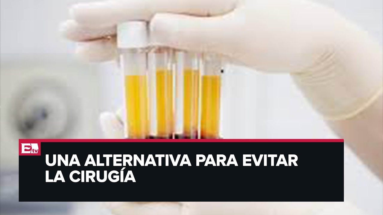 Punto y coma: Plasma rico en plaquetas