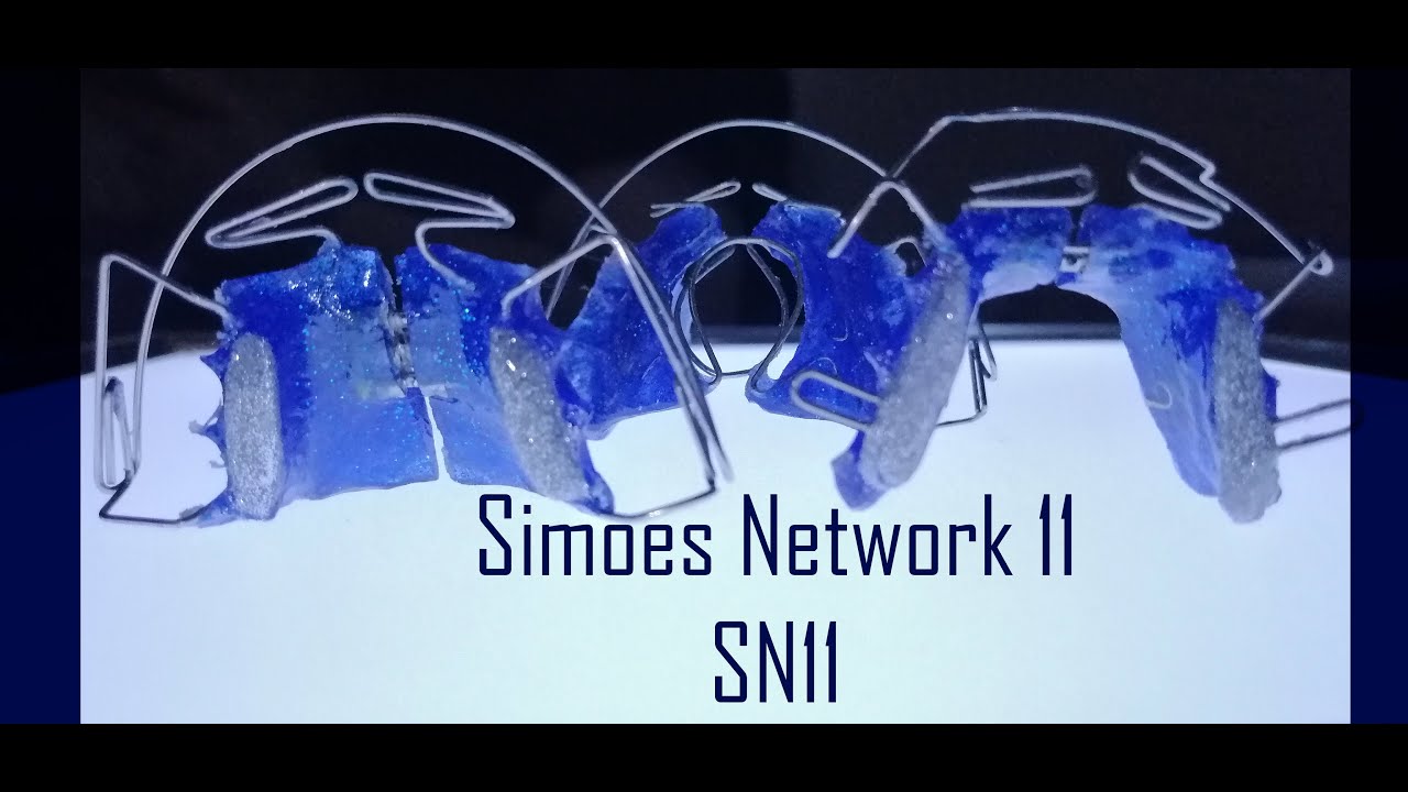 Elaboración de SN11 Simoes Network 11 | Elena Dental Art & More