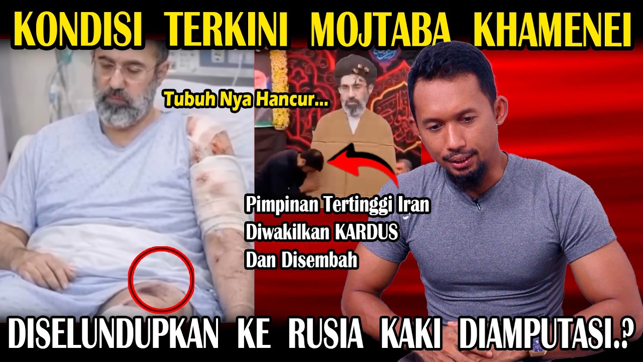 Mojtaba Khamenei Kritis Kabur Ke Rusia Untuk Amput4s1 Kaki..?