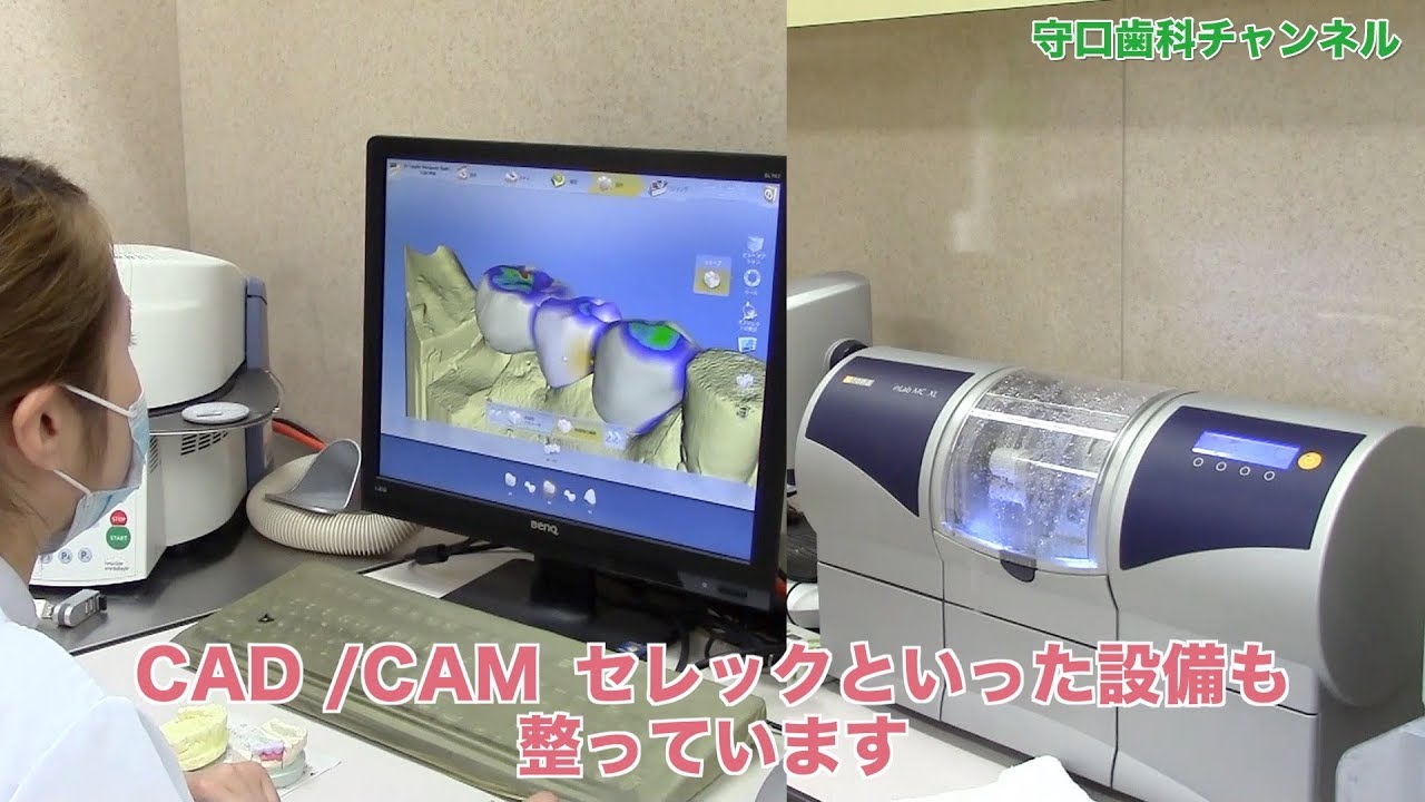【盛岡市 歯医者】守口歯科クリニックでは院内で入れ歯・補綴物を製作しています！_守口歯科チャンネル086（口腔ケアチャンネル）