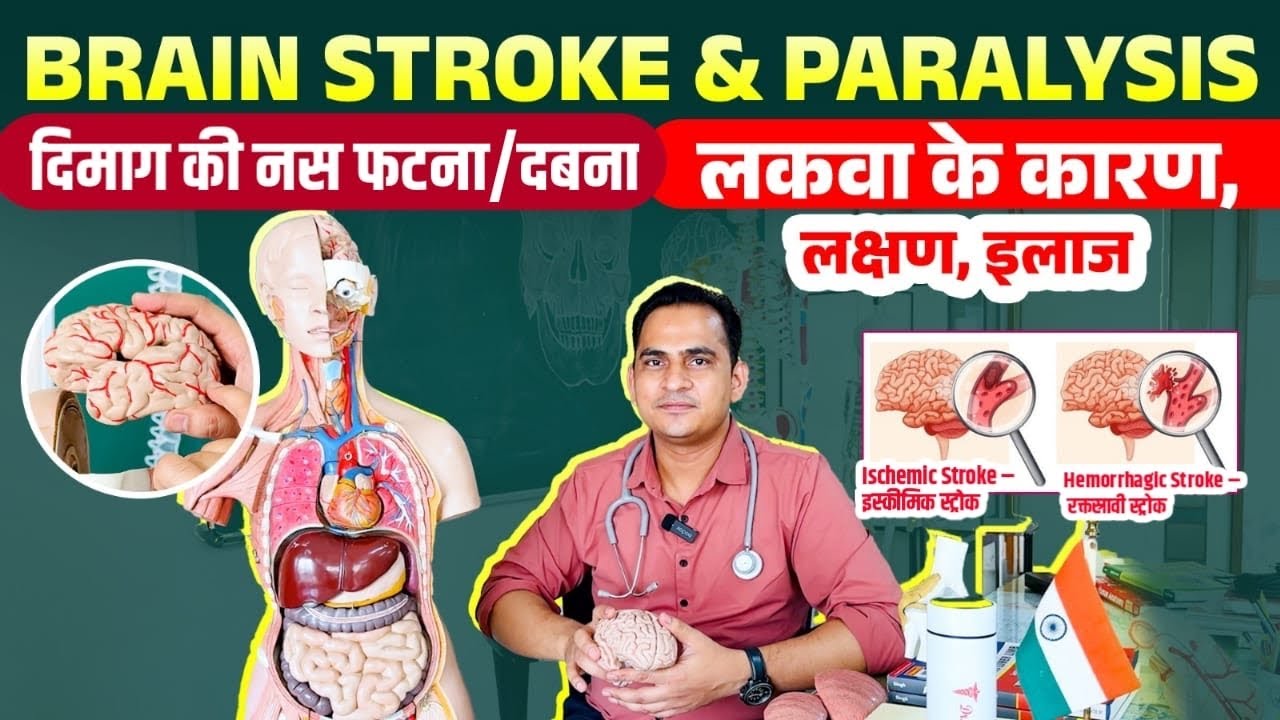 Brain Stroke & Paralysis | दिमाग की नस फटना एवं लकवा के कारण, लक्षण, इलाज | Haemorrhagic & Ischemic