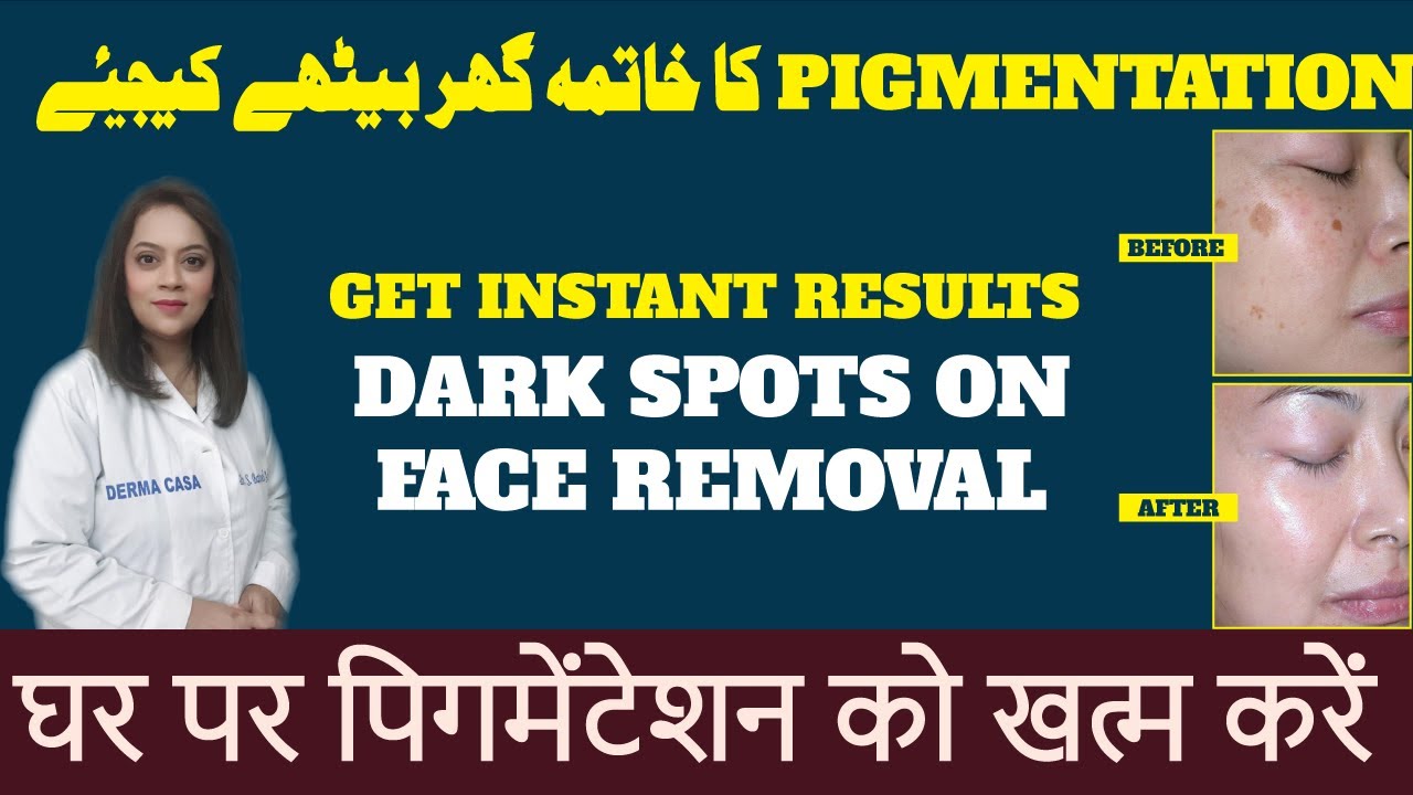 GET INSTANT RESULTS | Dark spots on face removal | dr batool ashraf official