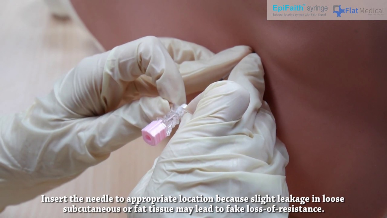 EpiFaith - Syringe: Techniques and How to Use