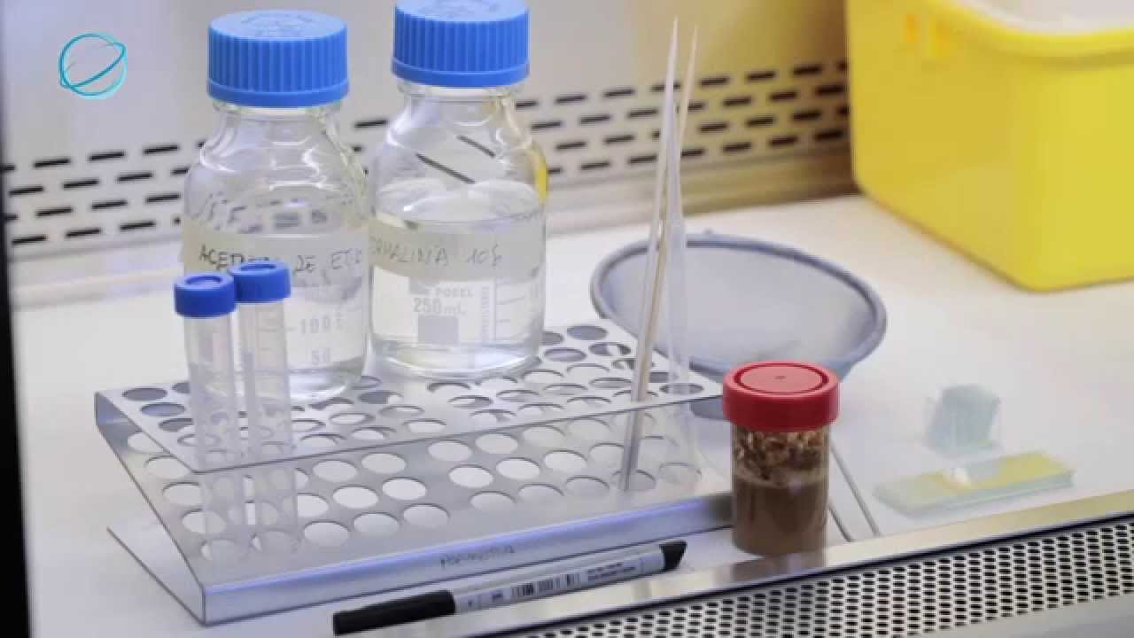 EHAS: Diagnóstico de Parásitos Intestinales (Concentración de Heces)