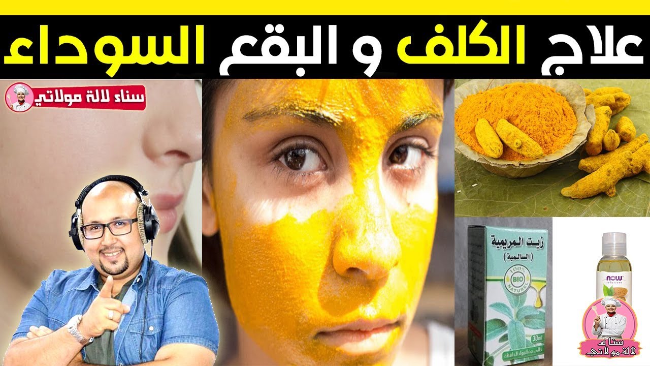 وصفة الخرقوم البلدي لعلاج الكلف والبقع السوداء في البشرة - الدكتور عماد ميزاب Dr imad mizab