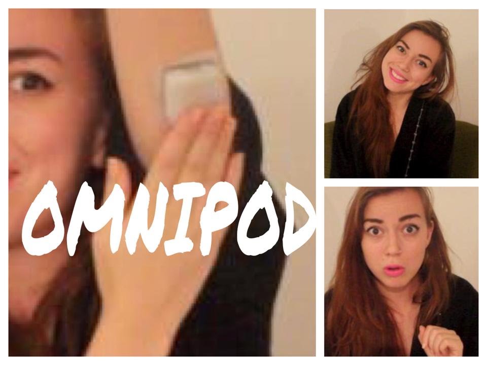 Pros & Cons of the Omnipod