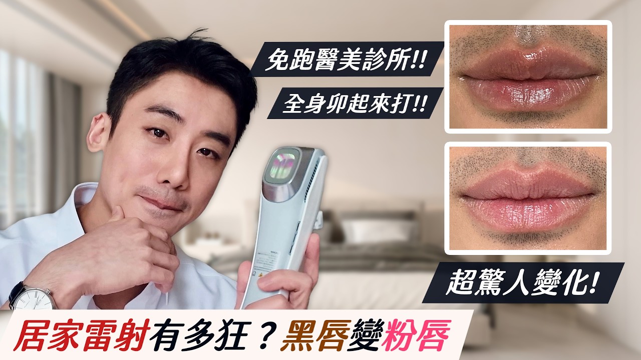 大黑唇意外變粉嫩 !? 居家雷射效果太狂，只打一次就見效！｜Ulike超光炮開箱實測