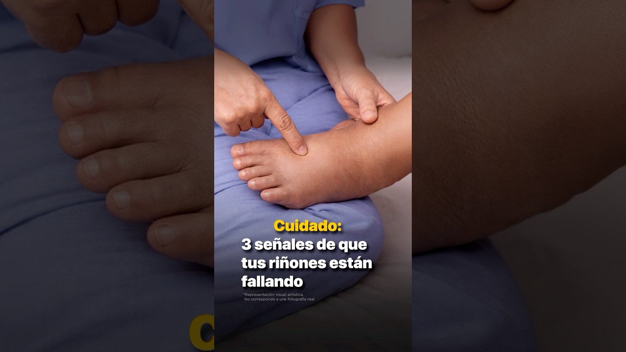 Cuidado: 3 se&ntilde;ales de que tus ri&ntilde;ones est&aacute;n fallando  @laura_primerosauxilios