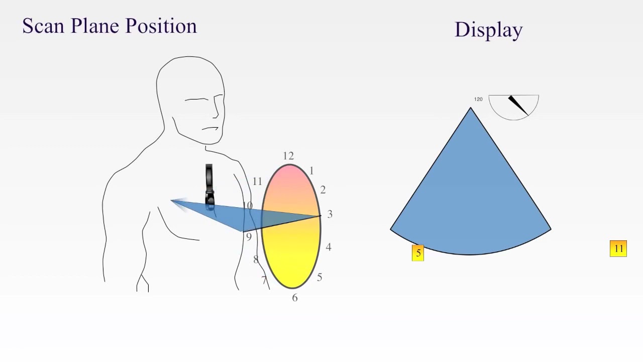 TEE Imaging Planes and Orientation