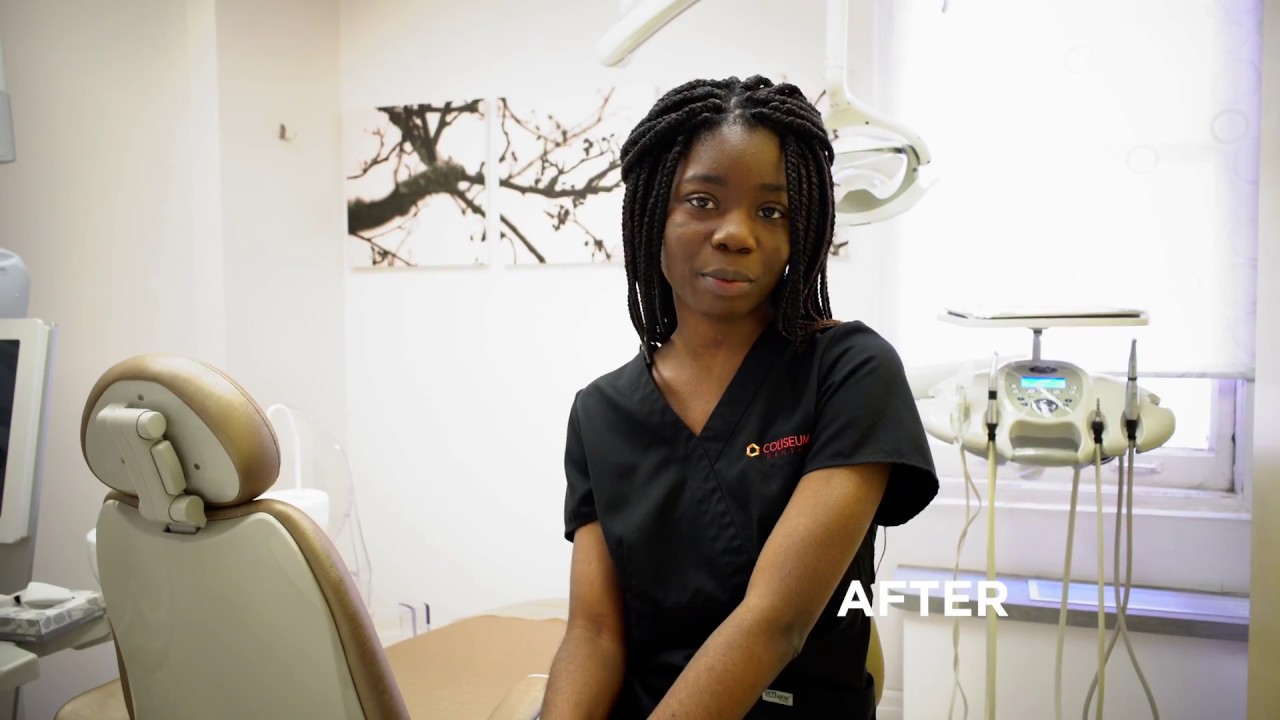 Laser Gum Depigmentation (Gum Bleaching) at Coliseum Dental