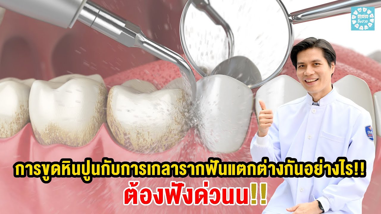 การขูดหินปูนกับการเกลารากฟันแตกต่างกันอย่างไร!!