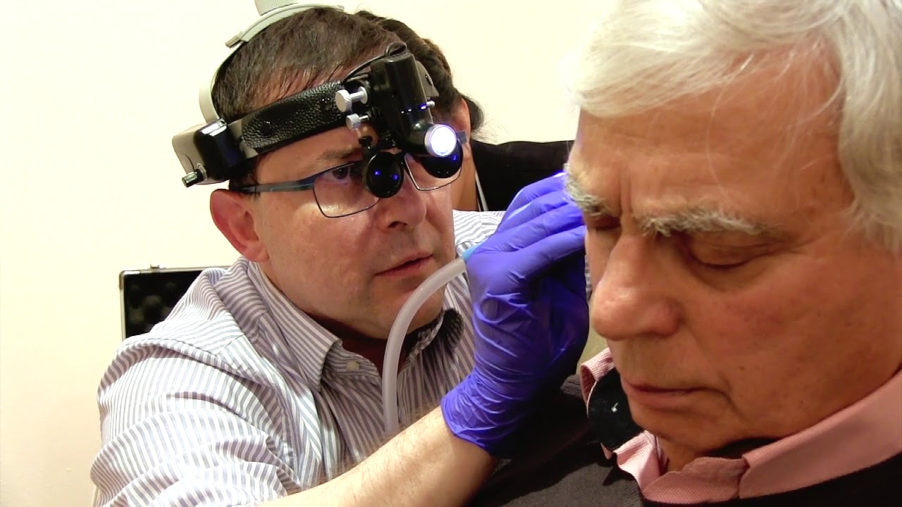 Microsuction Ear Wax Removal Clinic Near Me