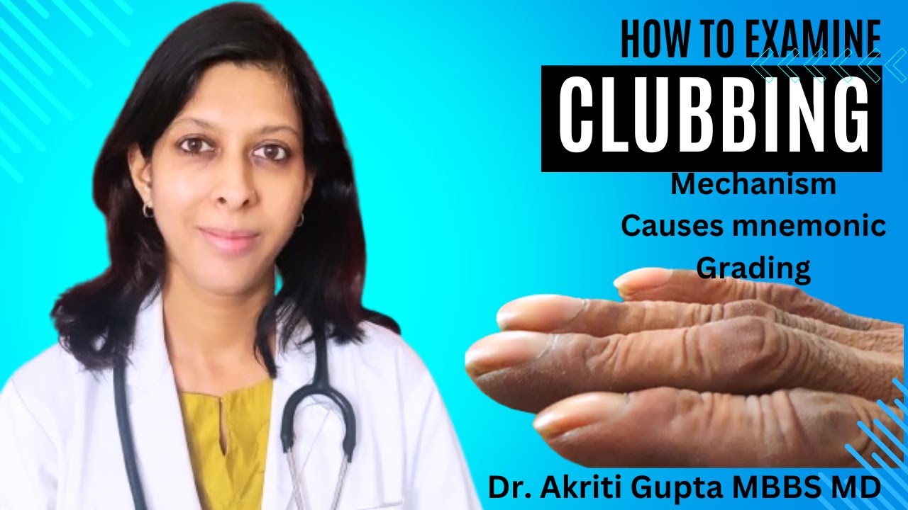 Clubbing : Clinical examination