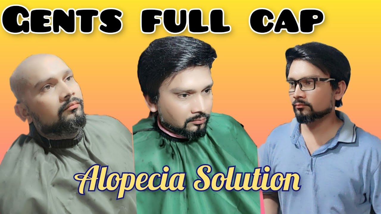 Hair Wig Gents Full Cap Hair Replacement & Patch Raghib Qureshi +923004272353, 03184120846