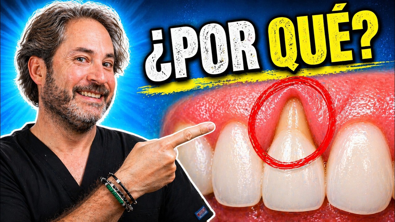 ✅ 𝗘𝗡𝗖𝗜𝗔𝗦 𝗥𝗘𝗧𝗥𝗔𝗜𝗗𝗔𝗦 SOLUCIÓN NATURAL : Mejor tratamiento para encías inflamadas y retraidas
