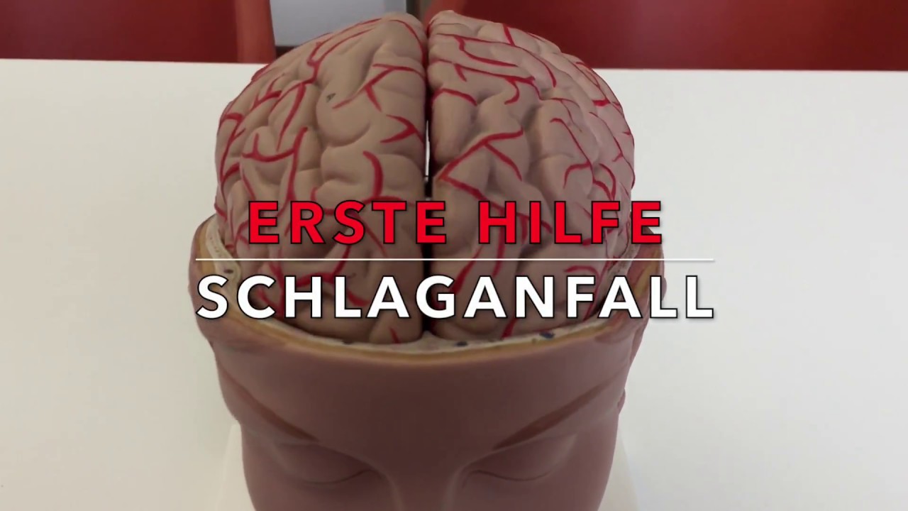FAST-Test: Die rettende Regel beim Schlaganfall