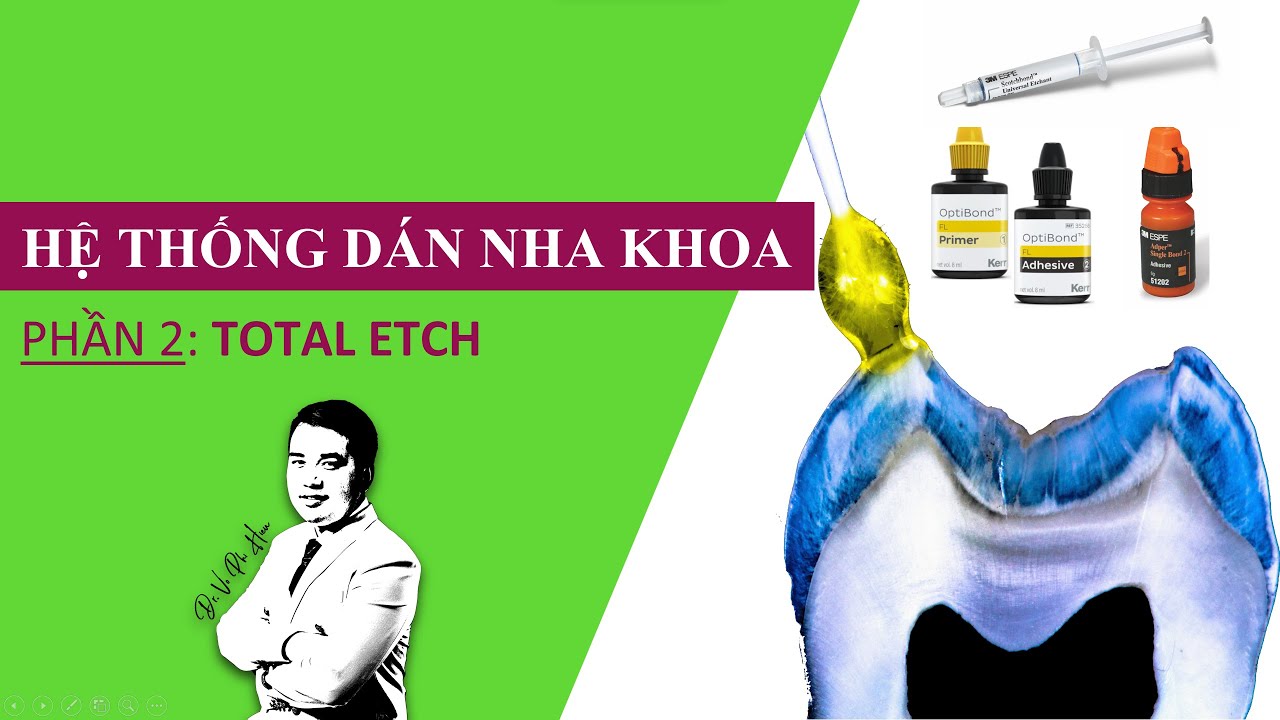 Hệ thống D&aacute;n Nha khoa | Phần 2: Total Etch