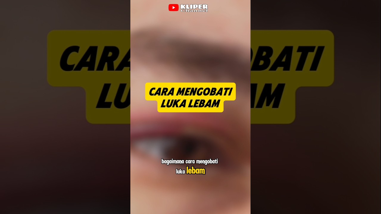 Cara Mengobati Luka Lebam Yang Susah Hilang #luka #lebam #shorts #kliperchannel