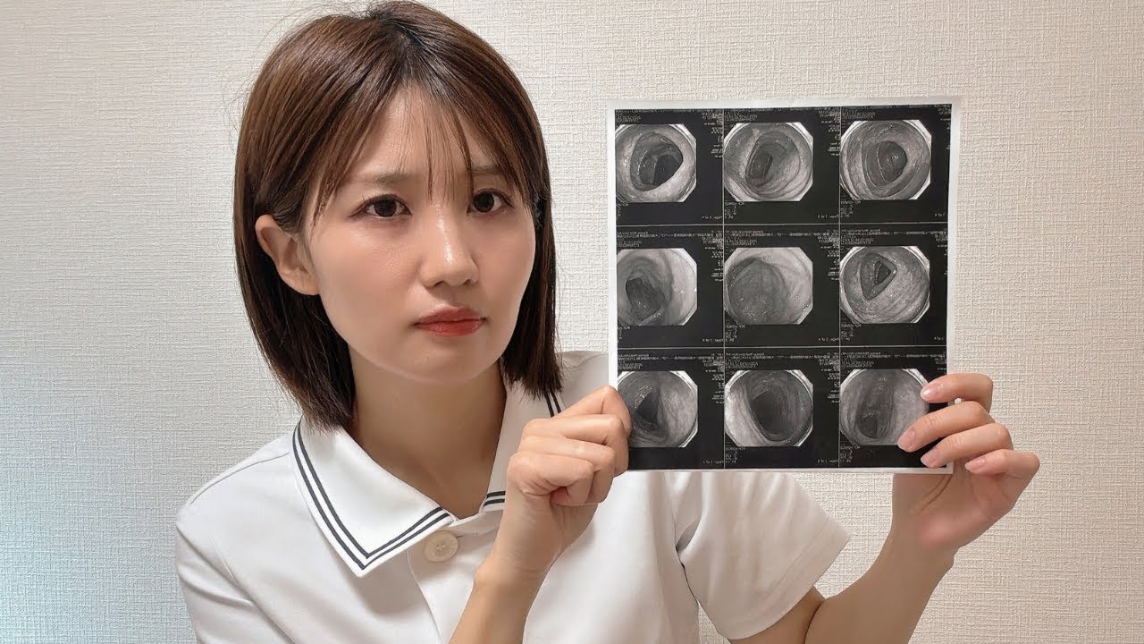 大腸カメラの結果が出ました。皆さんも気をつけてください。【注意喚起】