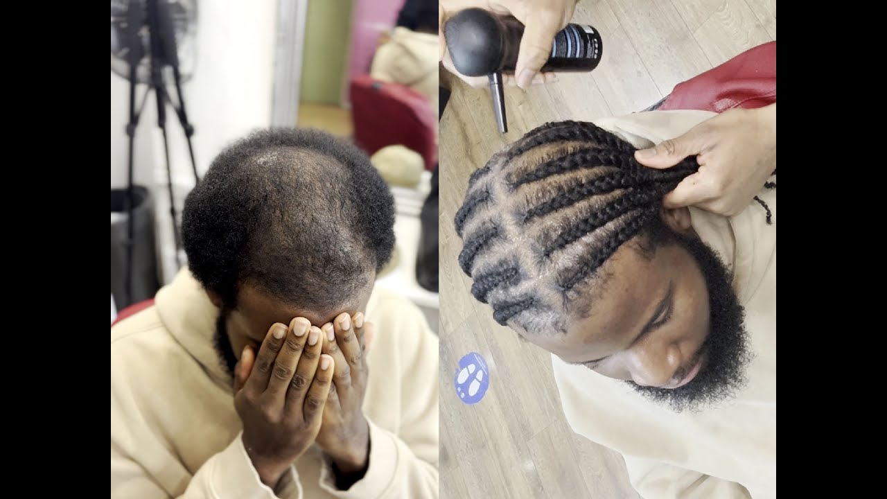 Side braids on thinning hair 