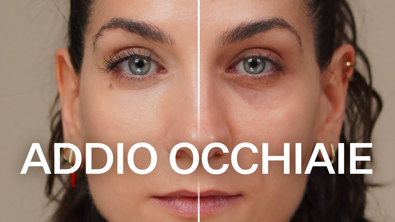 Come coprire le occhiaie: 3 tecniche efficaci per ogni tipo