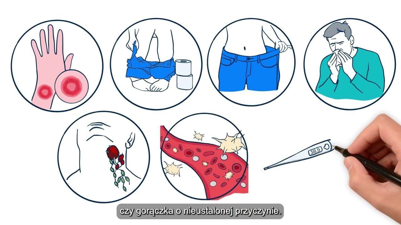 Podstawowe informacje na temat HIV AIDS