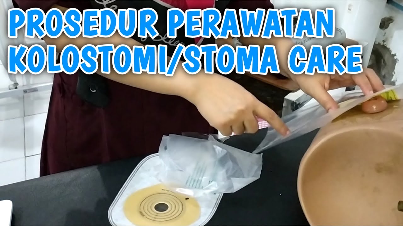 VIDEO PEMBELAJARAN PROSEDUR PERAWATAN KOLOSTOMI/STOMA CARE