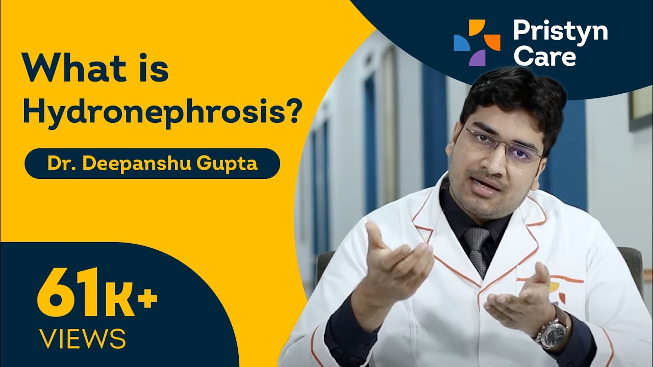 What is Hydronephrosis? | Swelling of Kidney - For FREE Consultation Call On 08065105262