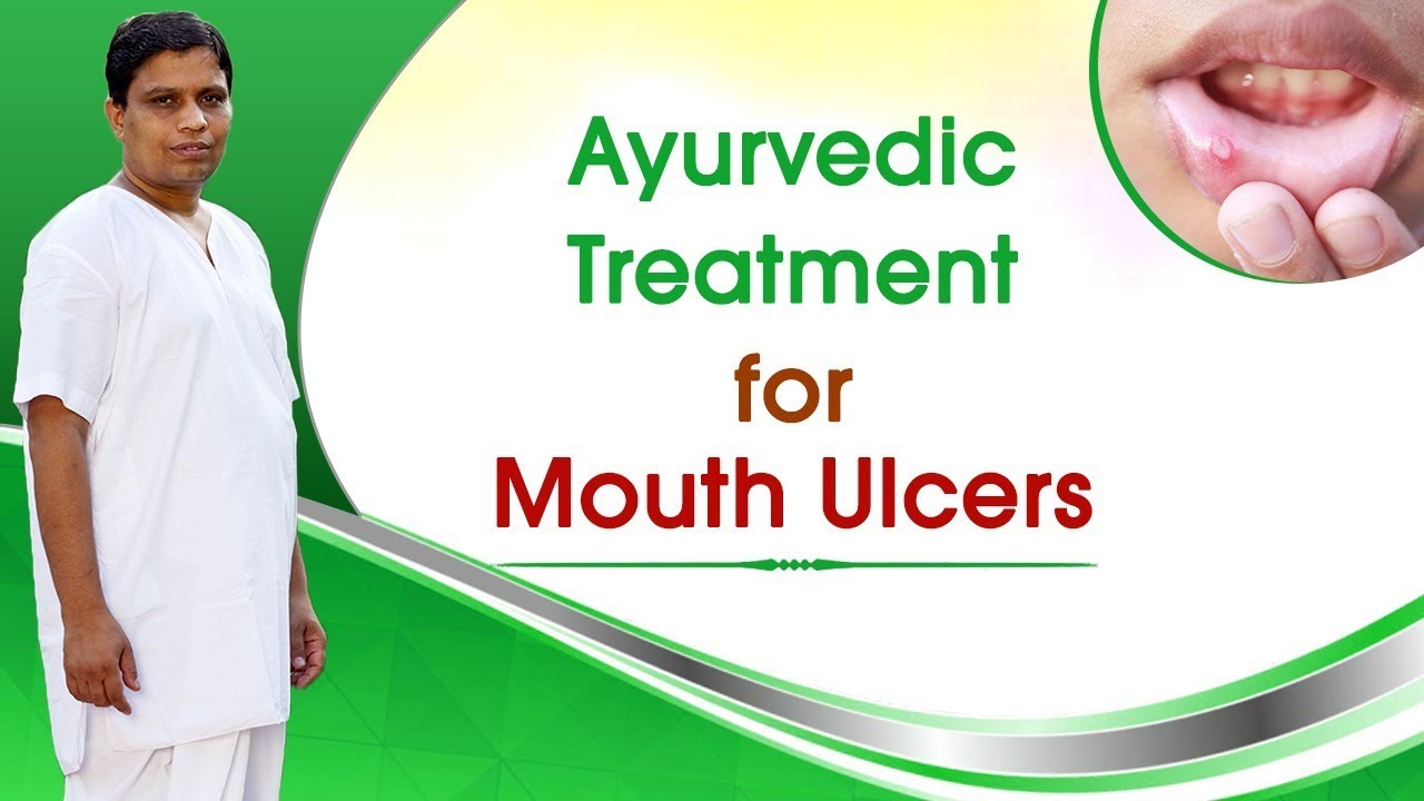 Ayurvedic Treatment for Mouth Ulcers | Acharya Balkrishna