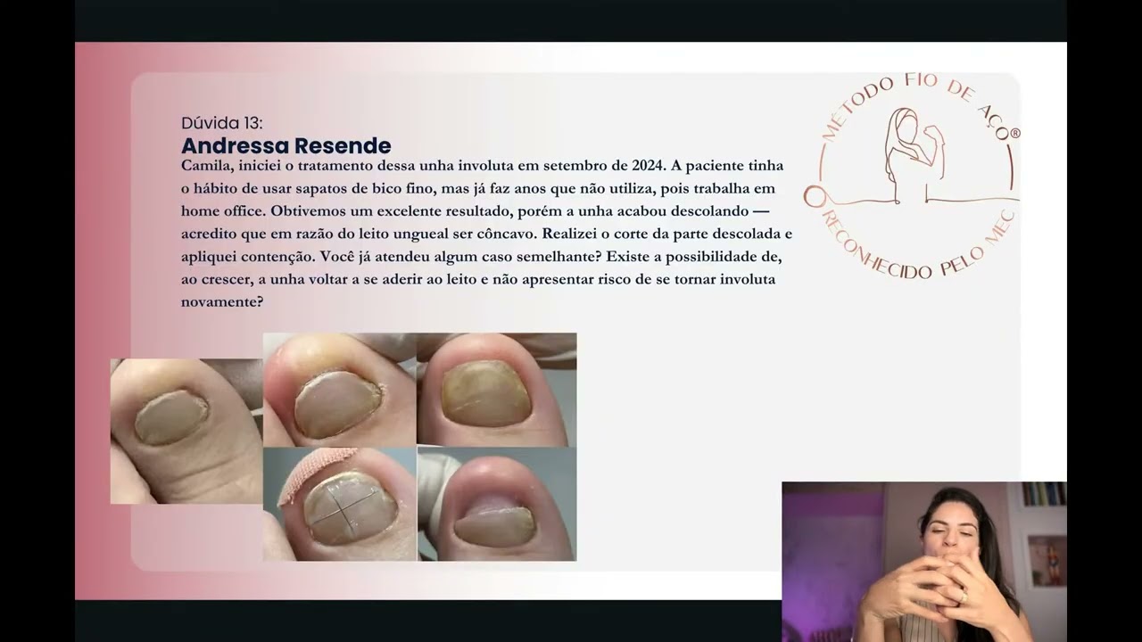 Ação involuta: até onde a órtese realmente funciona?