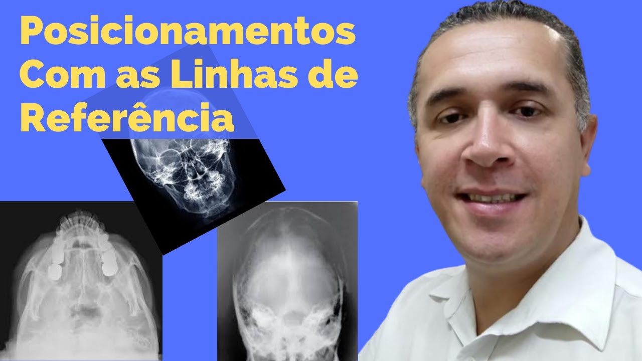 Posicionamentos Especiais de Crânio